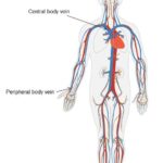 Can we assess central Fontan haemodynamics using peripheral venous pressure? Can we assess central Fontan haemodynamics using peripheral venous pressure?