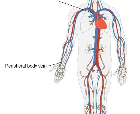 Can we assess central Fontan haemodynamics using peripheral venous pressure? Can we assess central Fontan haemodynamics using peripheral venous pressure?