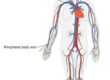 Central venous pressure fontan