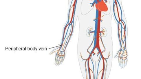 Central venous pressure fontan Central venous pressure fontan