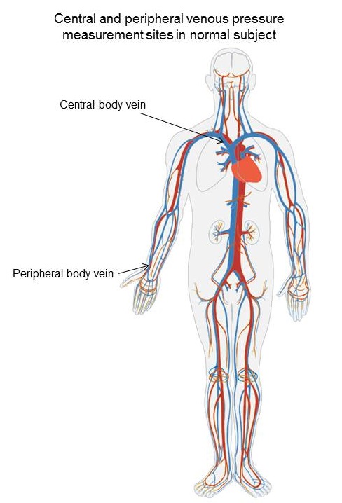 Central venous pressure fontan