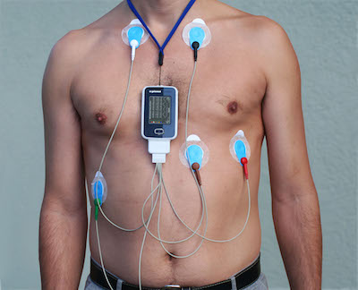 24 hour ECG Holter recording