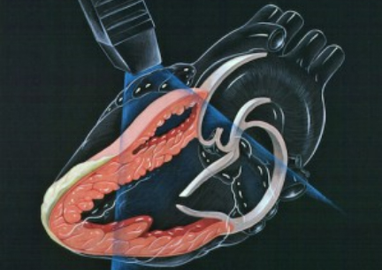 Echocardiogram