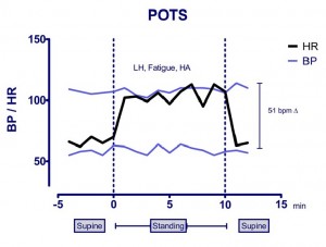 Postural Tachycardia Syndrome (POTS) - Child Heart Specialist