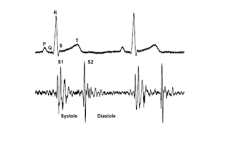 heart murmurs