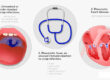 Rheumatic fever2