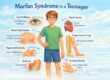 Marfan Syndrome educational illustration